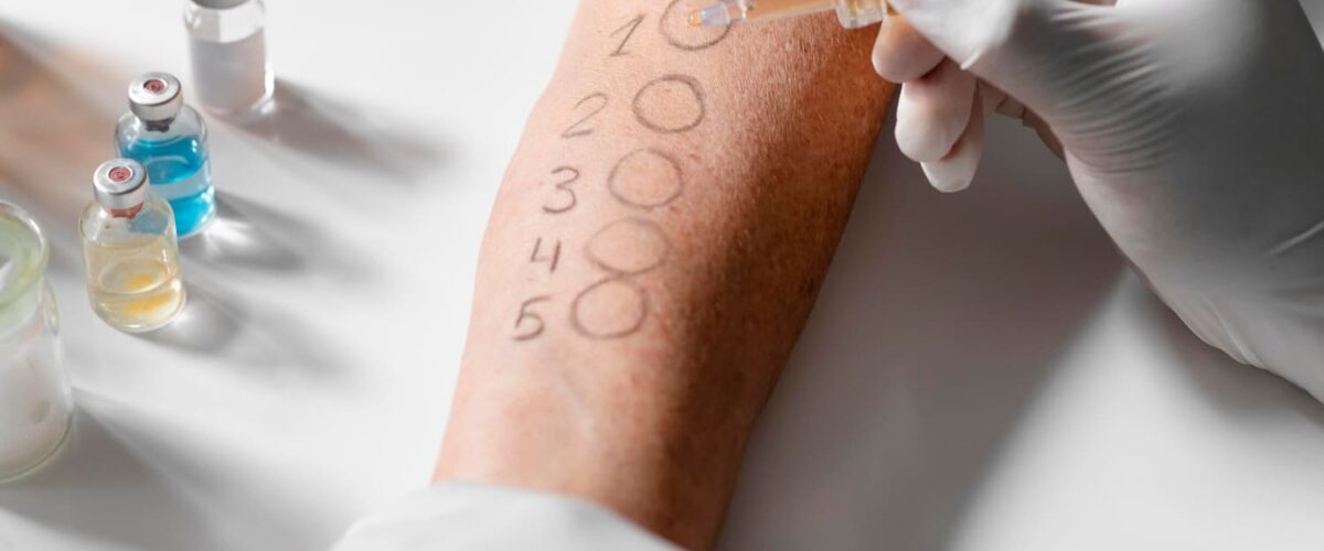 Allergy Test Malaysia