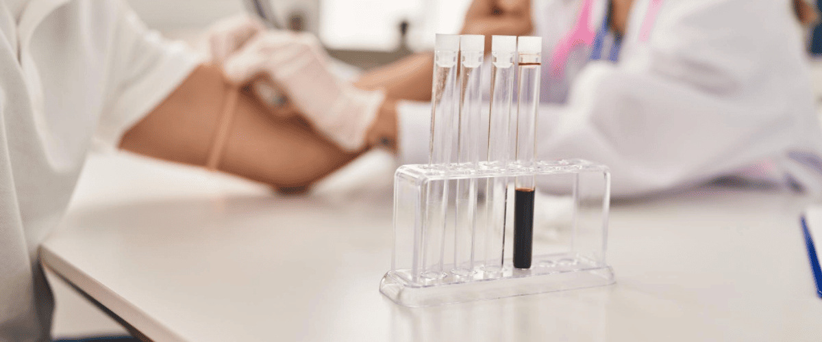 tubes-in-the-lab-genetic-carrier-screening