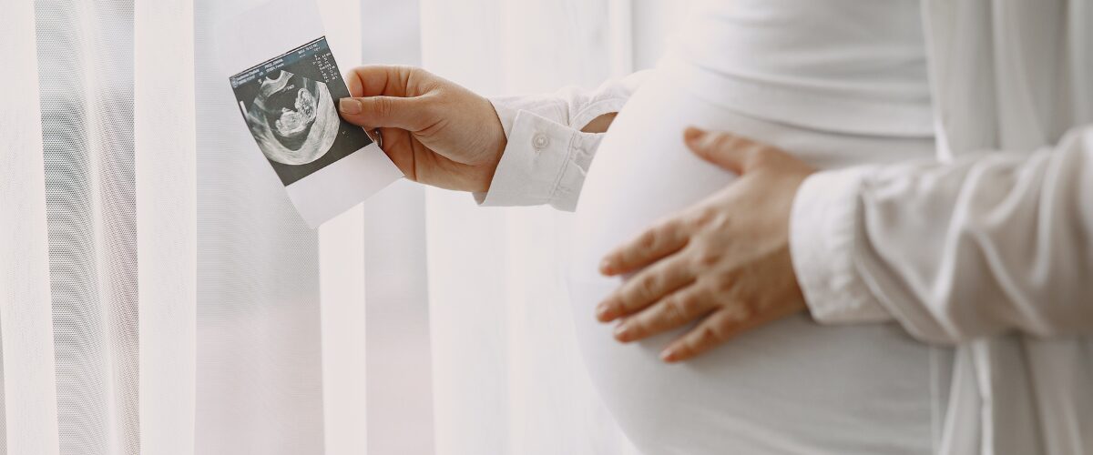 pregnant-women-holding-ultrasound-scan-image