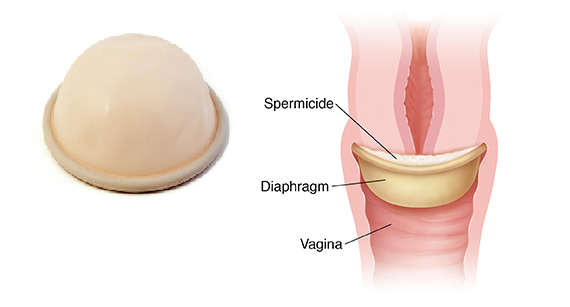 Diaphragm