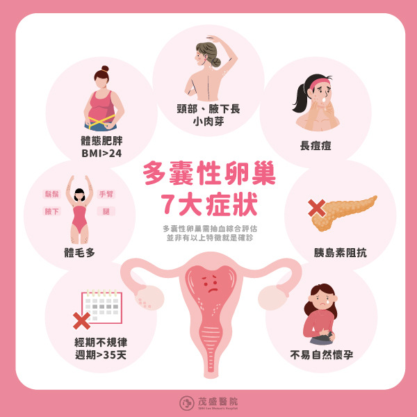 多囊卵巢7大症状图表