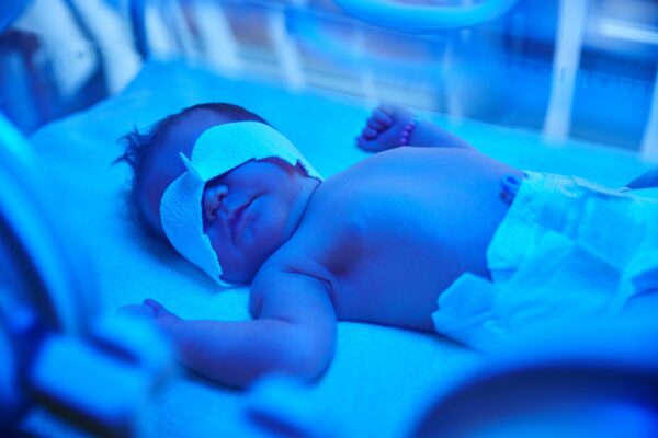 new born jaundice phototheraphy new born jaundice phototheraphy